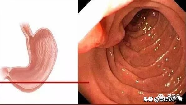 医生做胃镜检查时会看食道的吗,胃镜检查全过程视频消化内科检查