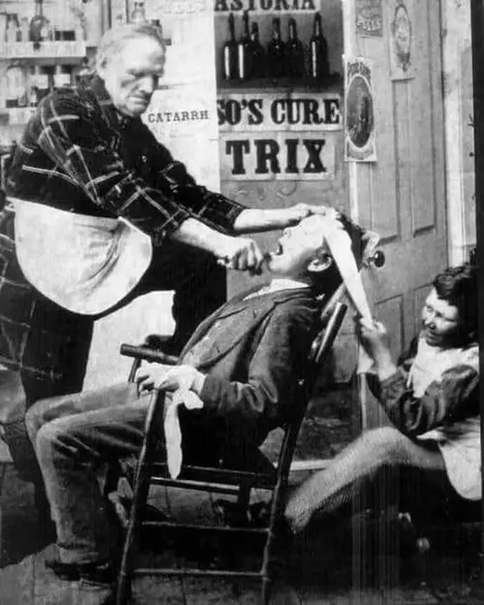 成人智齿怎么拔牙最快而且不疼,严重智齿拔牙全过程