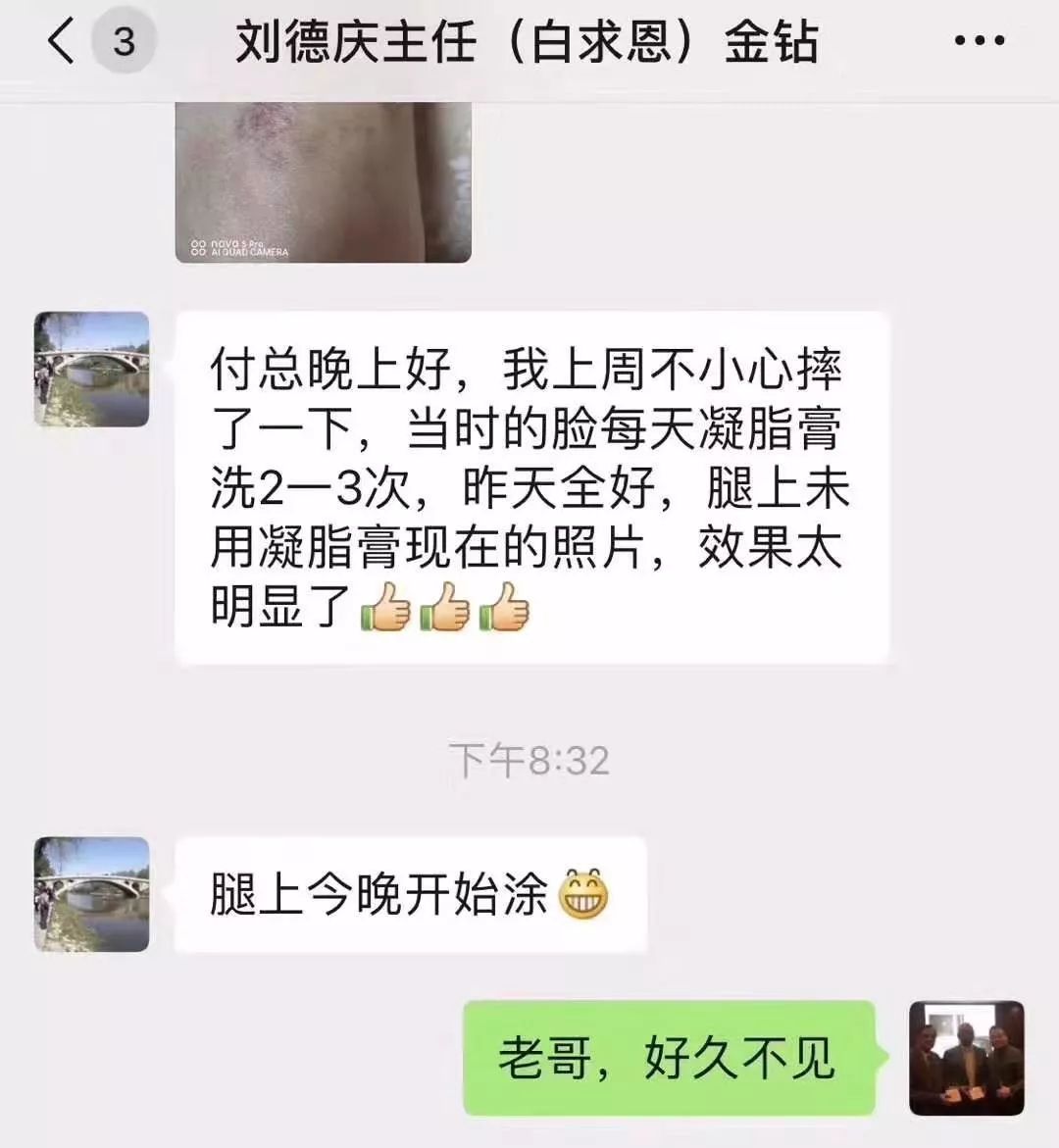 紫檀膏对皮肤有什么好处,紫檀膏治什么病