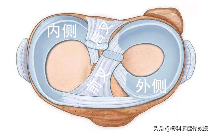 半月板损伤的介绍,半月板损伤科普动画