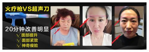 琦草集“火疗枪·细胞SPA量子热疗仪”震撼全国发布