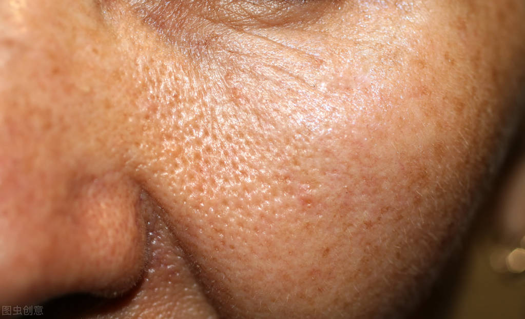 自己怎么改善毛孔粗大缩小毛孔,学生党平价毛孔收缩改善毛孔粗大