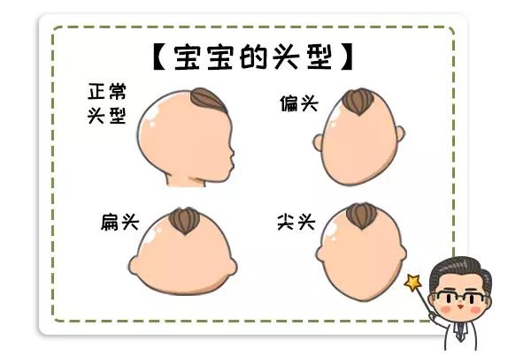 宝宝头睡偏了可以理哪种发型,头睡偏了怎么矫正儿童头型