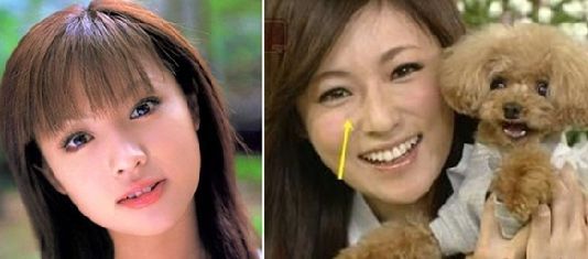 日本整容真的很好吗,日本整容vs韩国整容图片对比