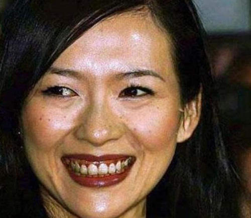 皮秒激光和普通激光怎么看出区别,皮秒激光就是镭射净肤吗