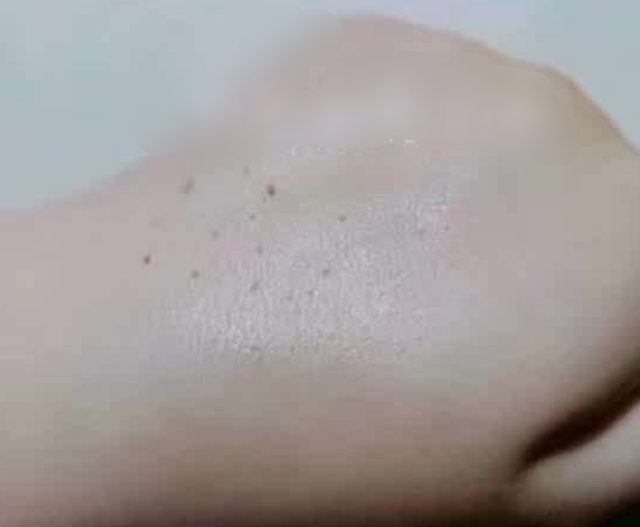 怎么安全有效去除黑头,怎么安全去黑头