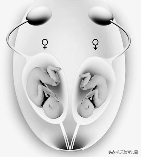 婴幼儿常见妇科病有哪些,有什么比较严重的妇科病