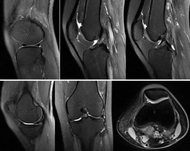 mri临床医师必读电子书,临床医生如何读mri