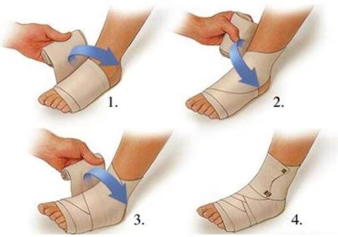 踝关节扭伤后的正确处理方法,踝关节扭伤应该如何正确处理