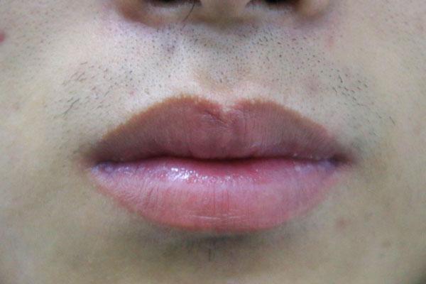 老人临终前说话有何征兆,老年人病重临终前的征兆