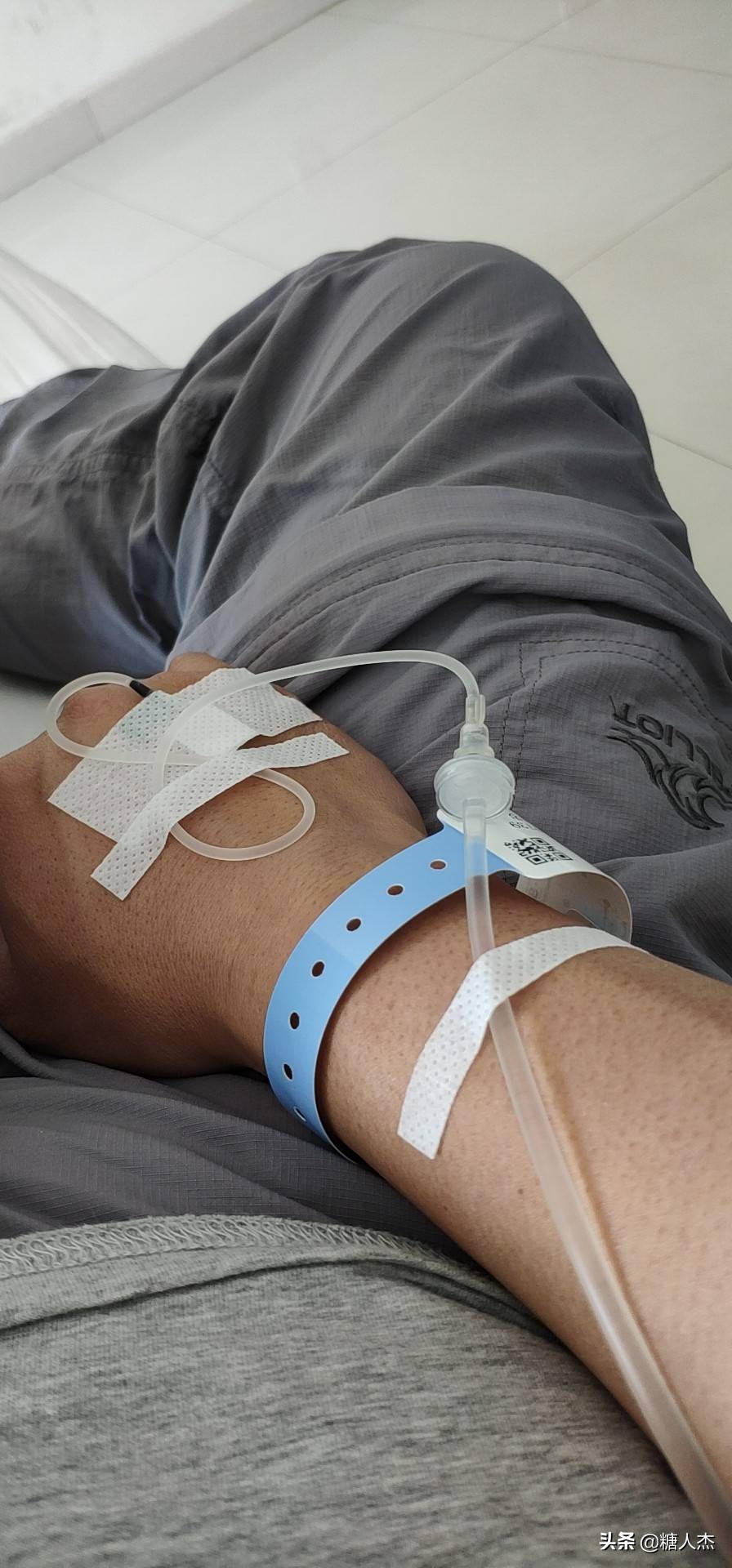 糖人杰用的动态血糖仪品牌,雅培瞬感无创血糖仪动态血糖仪