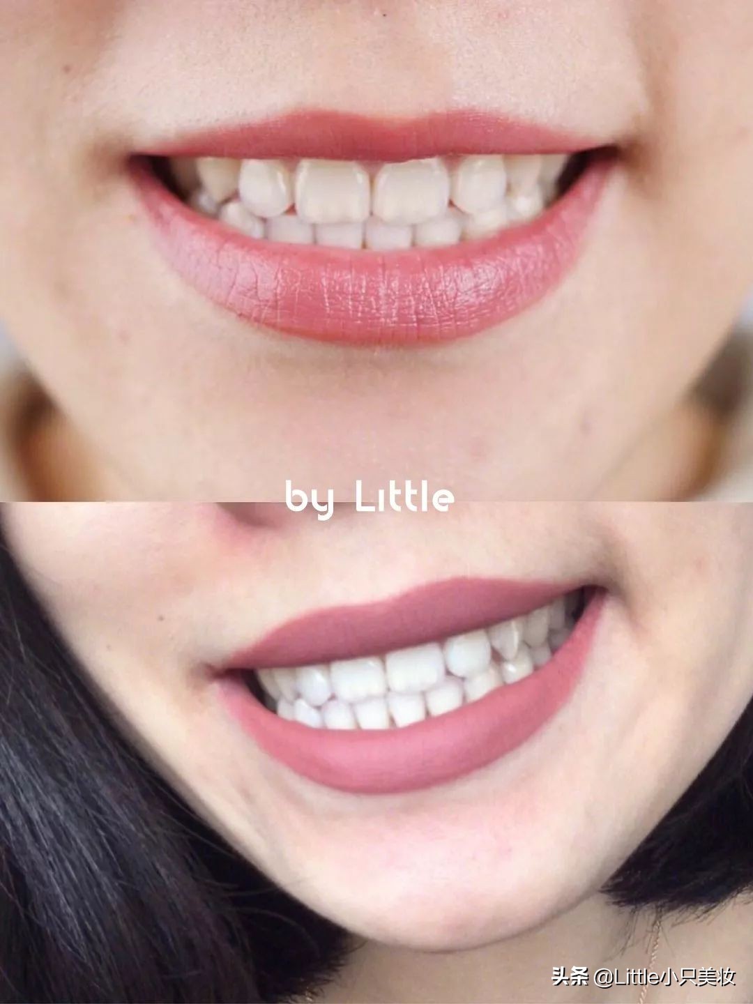黄牙妹用什么美白,最全牙齿美白攻略