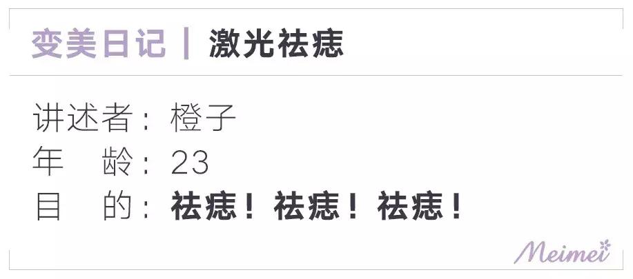 激光祛痣亲身经历和感受,激光祛痣亲身经历