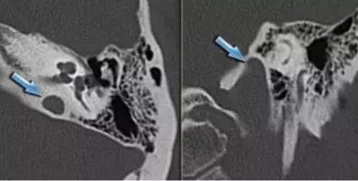 科普如何正确认识耳鸣,科普文的趣味性