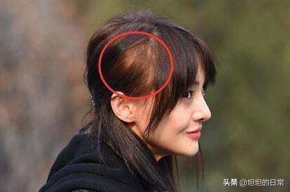 生过孩子的人，身体会有这5个特征，快来看看准不准