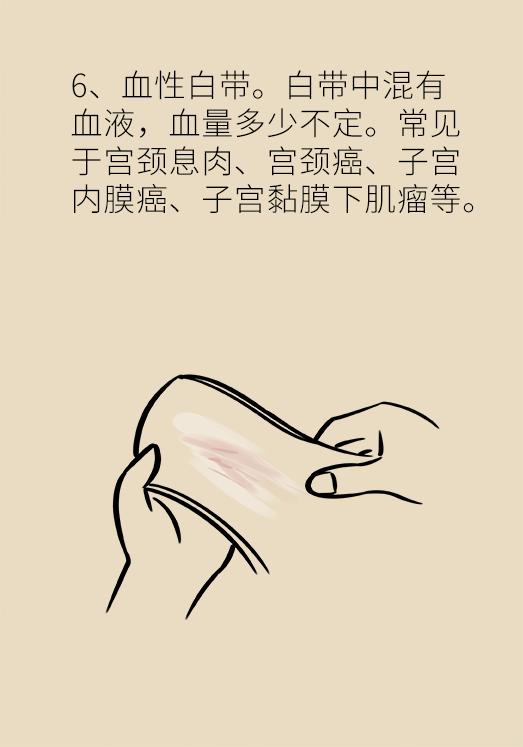 这些问题每个女性都有，稍不注意就会变成大病！