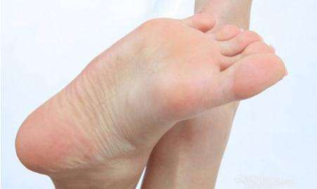 夏天脚气消失冬天脚气又有了,得了脚气香港脚有什么需要注意