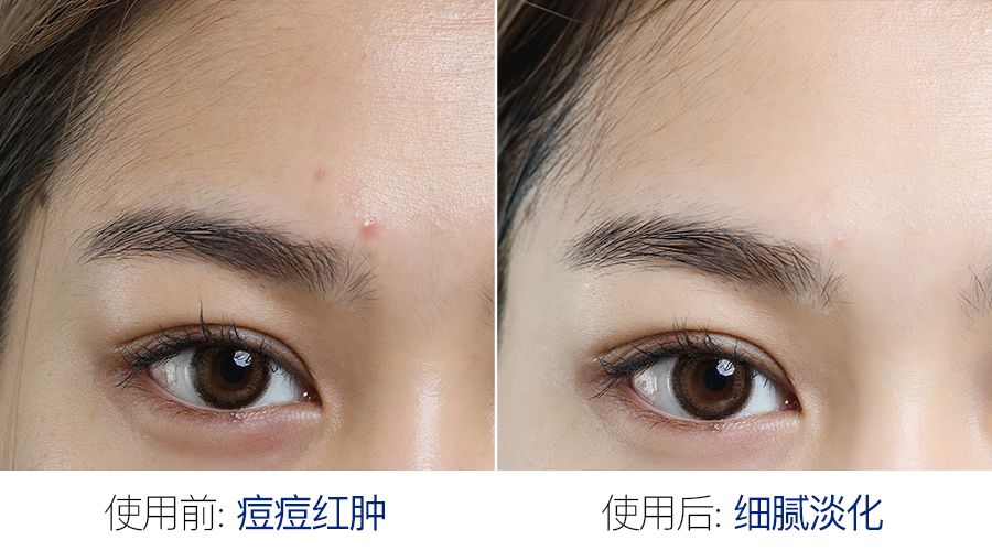 “神奇面膜”被疯抢！一片藏了8小时“美容觉”，醒来皮肤嫩透白