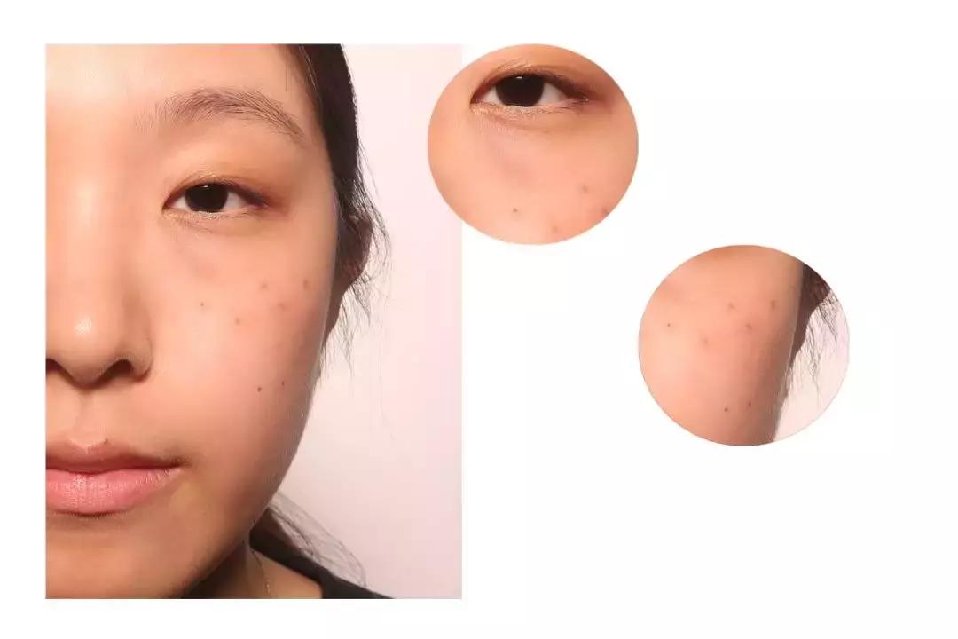 缇庡鐨偆绠＄悊鍖栧,缇庡闄㈠仛鑲岃偆閬憰