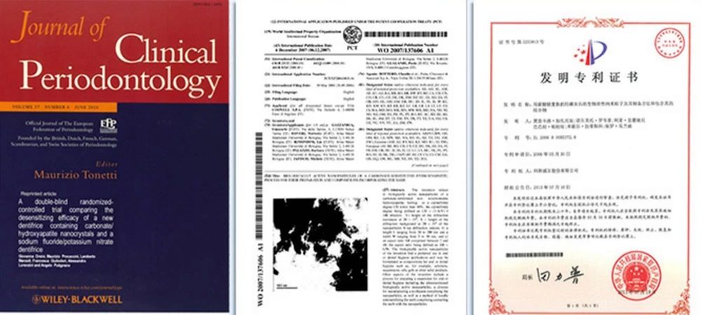 日本牙齿再生牙膏,牙齿咬东西酸软无力用什么牙膏