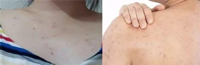 日本去螨虫皂,日本小黑皂号称螨虫克星