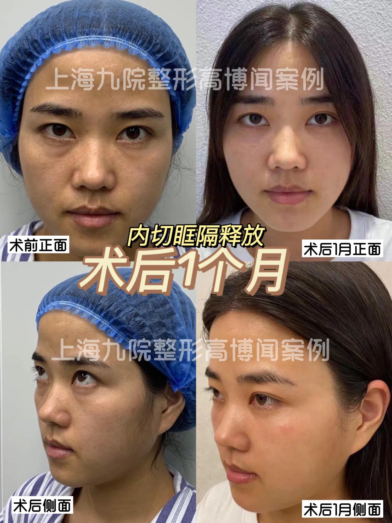 <html>
<head><title>502BadGateway</title></head>
<body>
<center><h1>502BadGateway</h1></center>
<hr><center>nginx</center>
</body>
</html>
<!--apaddingtodisableMSIEandChromefriendlyerrorpage-->
<!--apaddingtodisableMSIEandChromefriendlyerrorpage-->
<!--apaddingtodisableMSIEandChromefriendlyerrorpage-->
<!--apaddingtodisableMSIEandChromefriendlyerrorpage-->
<!--apaddingtodisableMSIEandChromefriendlyerrorpage-->
<!--apaddingtodisableMSIEandChromefriendlyerrorpage-->
