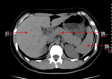 急诊科常见急腹症观察,腹部急诊影像大全值得收藏