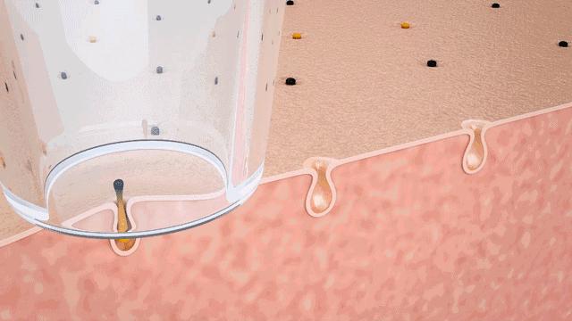 辣眼睛，有人用它吸出一整年的黑头，看完我果断下单了！