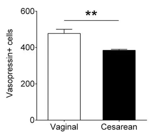 万不得已再剖吧！科学家发现剖宫产影响大脑发育和后代行为的机制，或与失去顺产对大脑神经的保护有关｜科学大发现