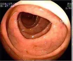 揭秘网红减肥产品,网红卖的减肥产品真的有效果吗