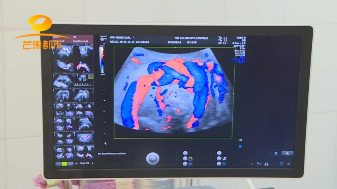 閬垮厤鑳庡効鑴愬甫缁曢娉ㄦ剰鍥涚偣,閬垮厤鑴愬甫缁曢杩欏嚑浠朵簨鍗冧竾鍒仛