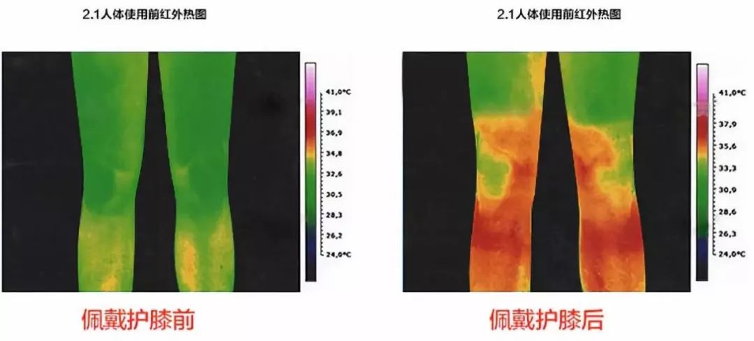 老寒腿护膝黑科技产品,日本加热护膝保暖老寒腿