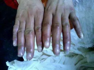 药店里几毛钱的药膏，竟能缓解治疗12种常见病痛！不看亏大啦~