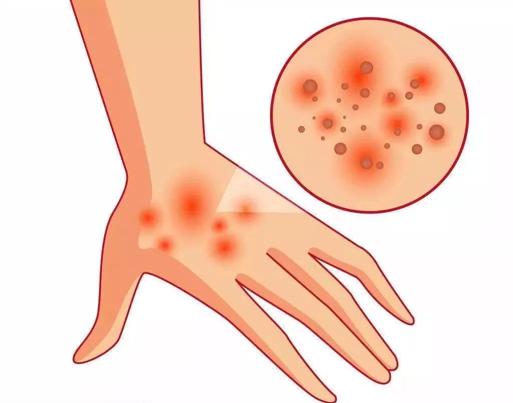 药店里几毛钱的药膏，竟能缓解治疗12种常见病痛！不看亏大啦~