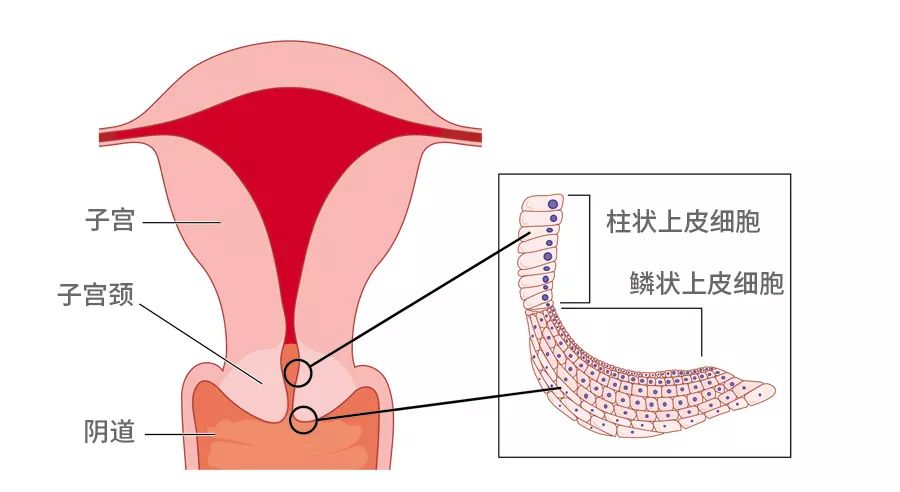 盘点专坑女性的妇科骗局,都有哪些专坑女性的妇科骗局