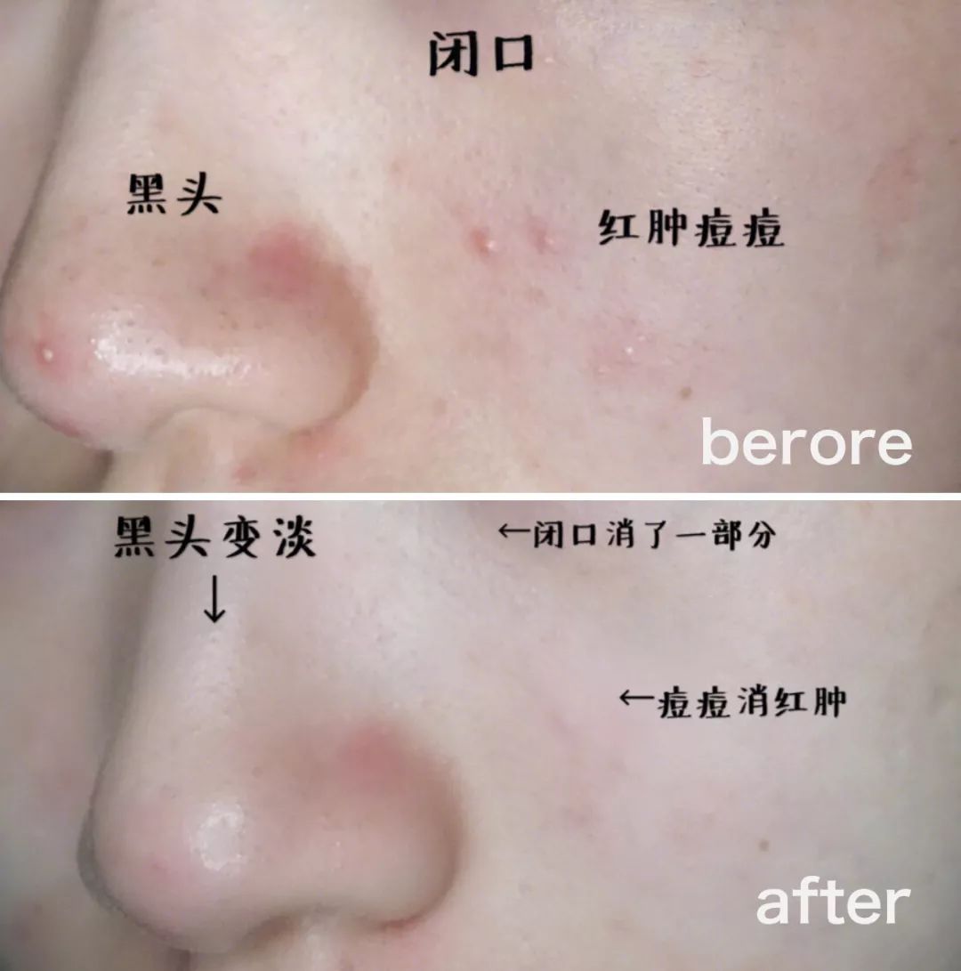 补水保湿滋润肌肤面膜10片装一盒,安瓶精华水润透亮睡眠面膜