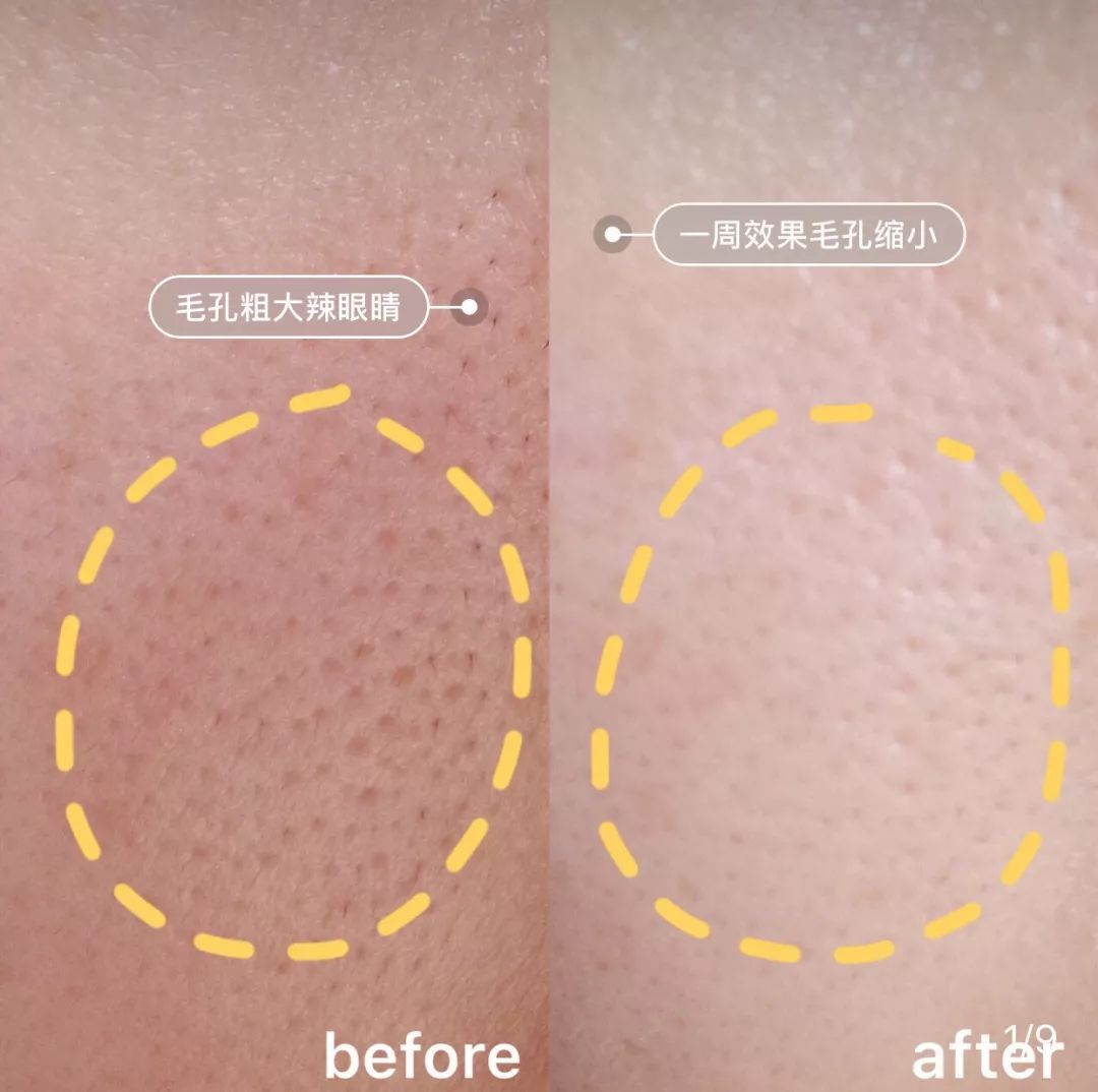 补水保湿滋润肌肤面膜10片装一盒,安瓶精华水润透亮睡眠面膜