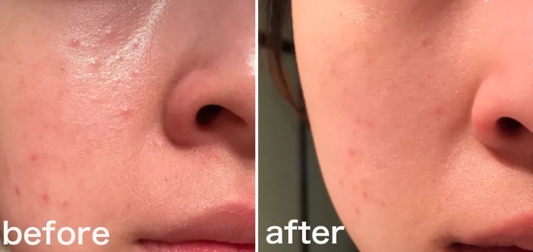 补水保湿滋润肌肤面膜10片装一盒,安瓶精华水润透亮睡眠面膜