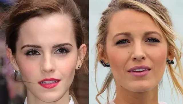 法令纹会让自己显老5到10岁,法令纹显老十岁教你解决