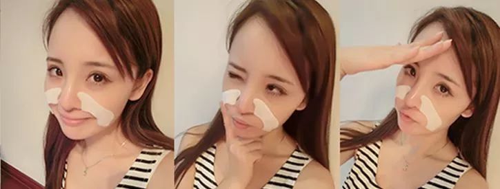 法令纹会让自己显老5到10岁,法令纹显老十岁教你解决