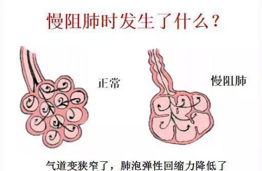 中国有多少人得了大病,近百年死亡最多的大病