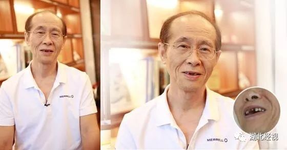 全城征集免费种植牙,全城征集免费种牙