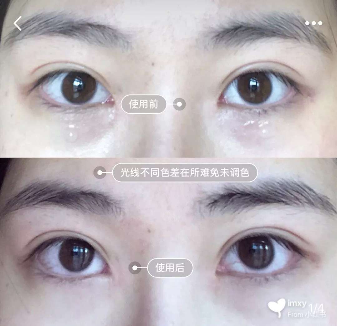 去细纹不长脂肪粒平价眼霜推荐,眼霜平价推荐去细纹30岁以上