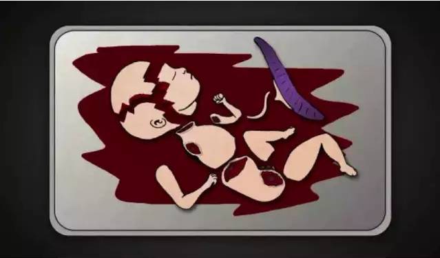 为什么一定要戴套？！情人节就要到了，为了自己，大家都看看吧……