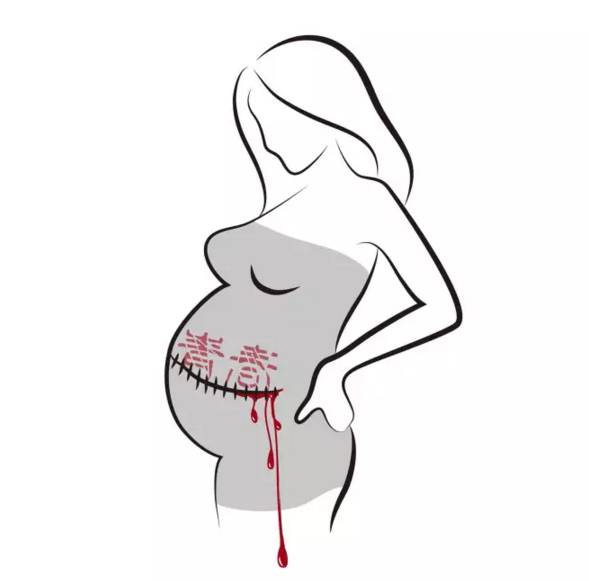 为什么一定要戴套？！情人节就要到了，为了自己，大家都看看吧……