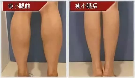 一周瘦腿方法筷子腿小红书,小红书一周内瘦腿方法
