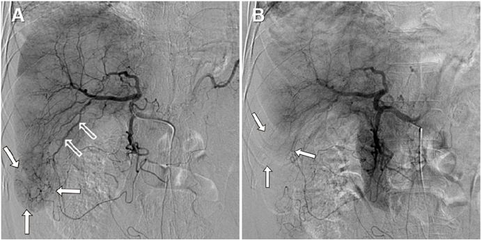 pubmed文献发表时间怎么看,pubmed文献检索实验报告