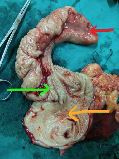 pubmed文献发表时间怎么看,pubmed文献检索实验报告