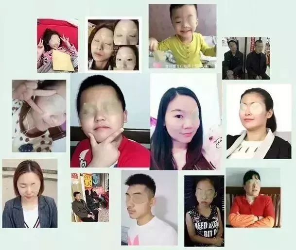 每天眼上敷一片，眼不花看得清，再也不怕近视了，男女老少都爱！