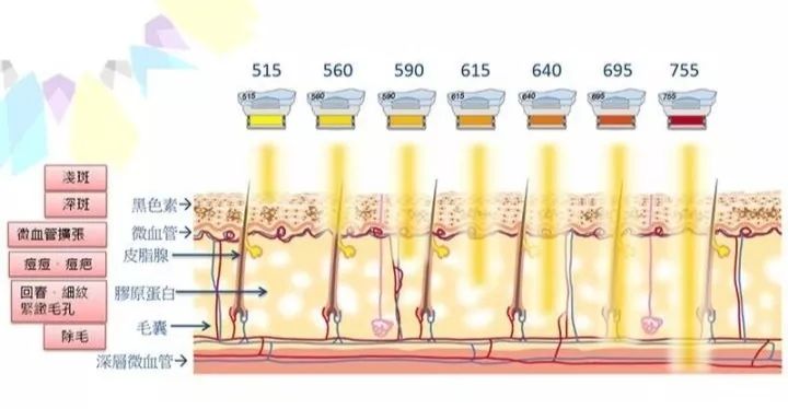中山一院光子嫩肤,中山七院点阵激光